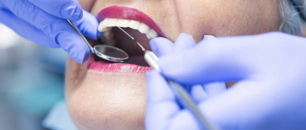 Best Emergency Wisdom Tooth Extraction in Hurstbourne, KY