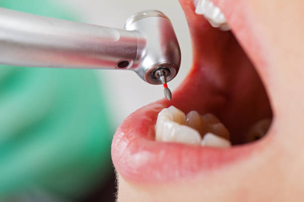 Best Emergency Root Canal Therapy in Hurstbourne, KY